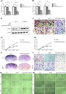 Corrigendum: Long Noncoding RNA NONHSAT079852.2 Contributes to GBM Recurrence by Functioning as a ceRNA for has-mir-10401-3p to Facilitate HSPA1A Upregulation